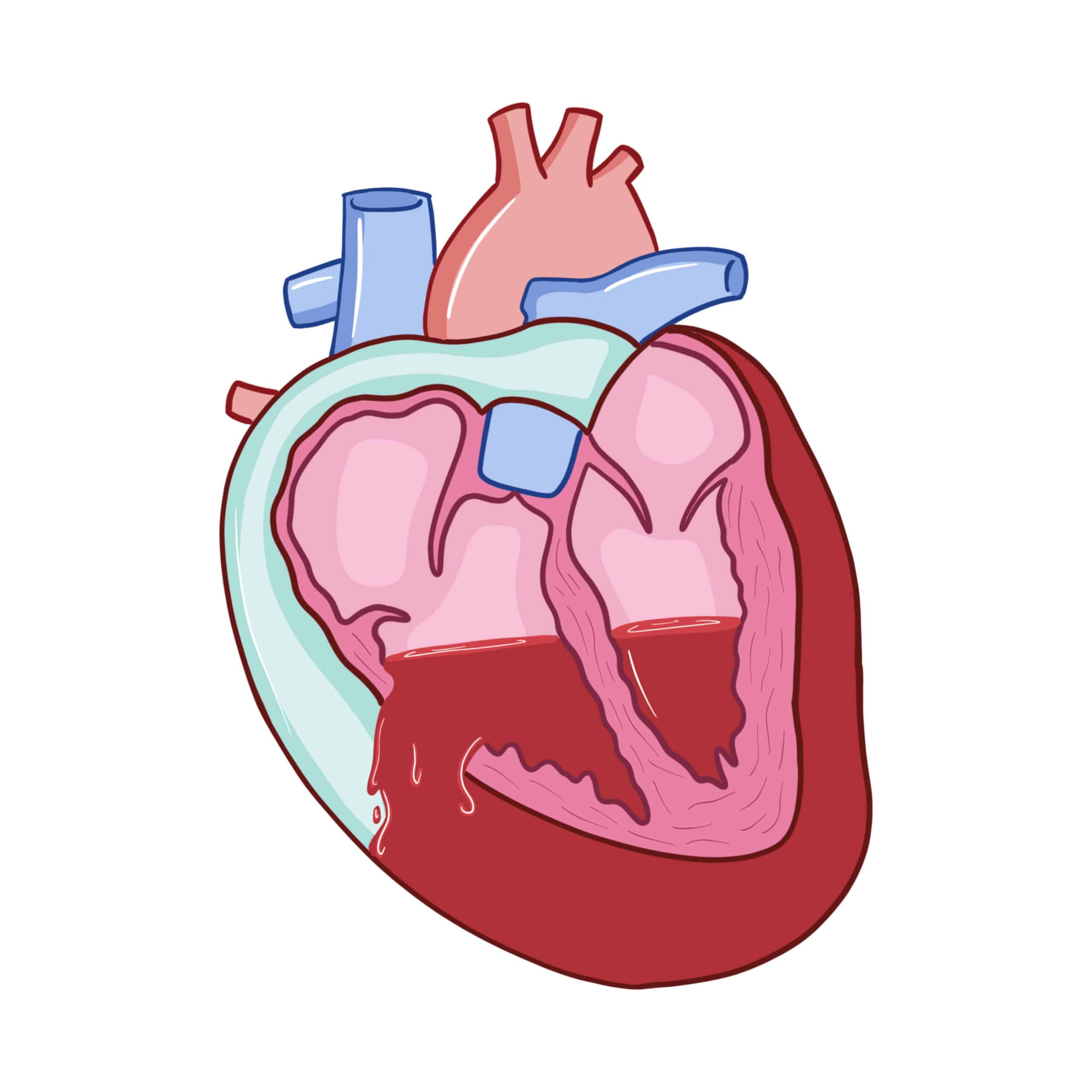 Cardiac Tamponade episode artwork