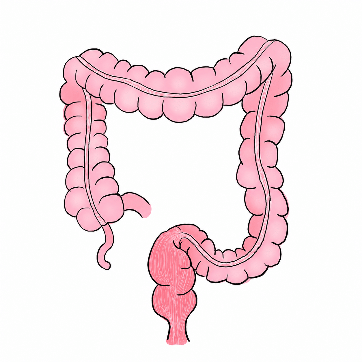 Surgical Management of Colorectal Cancer – Part 1 episode artwork
