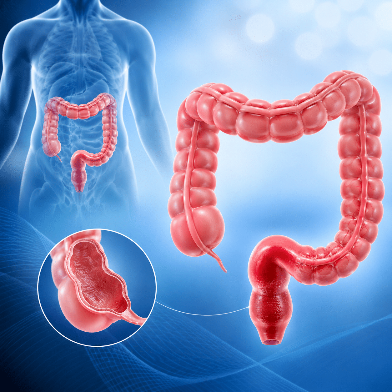 Surgical Management of Rectal Cancer – Part 2 episode artwork
